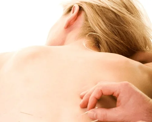 acupunture massage service